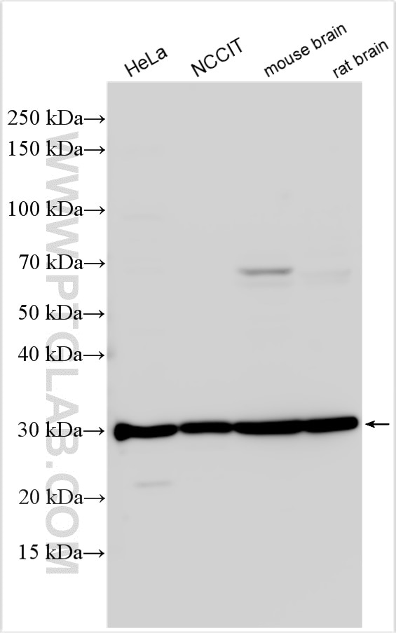 Western Blot (WB) analysis of various lysates using HMX2 Polyclonal antibody (23160-1-AP)