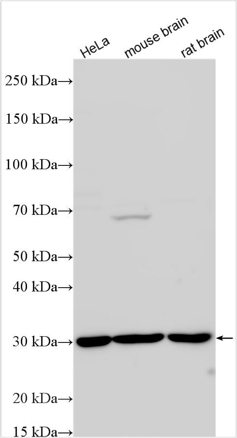 Western Blot (WB) analysis of various lysates using HMX2 Polyclonal antibody (23160-1-AP)