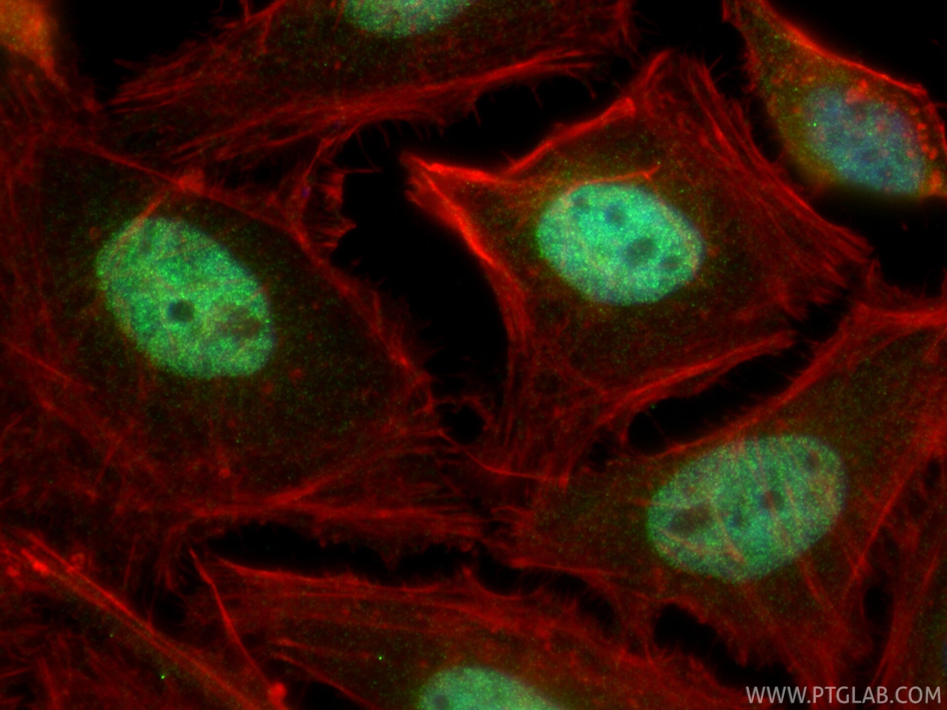 IF Staining of HeLa using 34183-1-AP (same clone as 34183-1-PBS) Immunofluorescence (IF) / fluorescent staining of HeLa cells using HMX3 Polyclonal antibody (34183-1-AP)