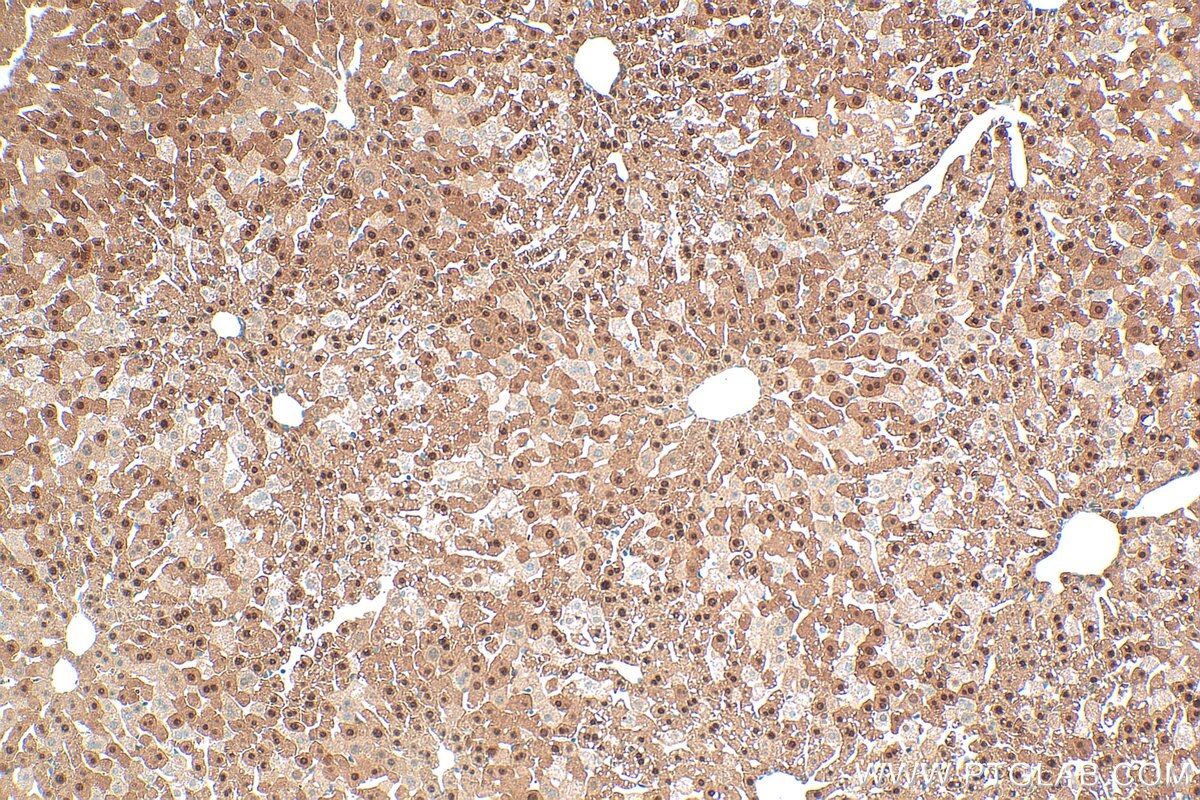 IHC staining of mouse liver using 34183-1-AP (same clone as 34183-1-PBS) Immunohistochemistry (IHC) staining of mouse liver tissue using HMX3 Polyclonal antibody (34183-1-AP)