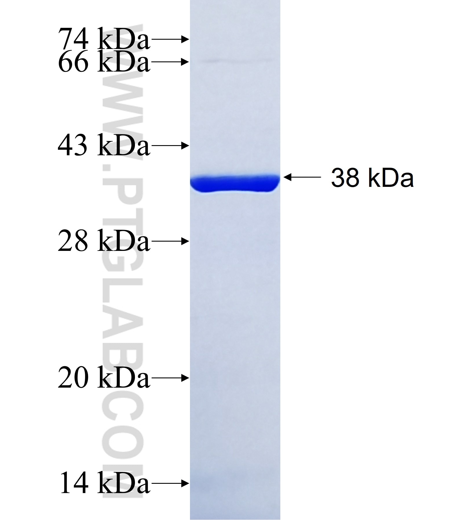 HMX3 fusion protein Ag41398 SDS-PAGE HMX3 fusion protein Ag41398 SDS-PAGE