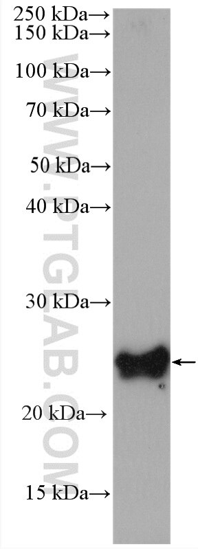 WB analysis of LNCaP using 14914-1-AP