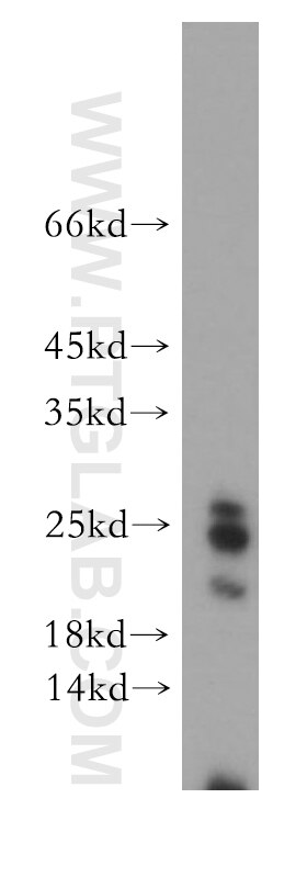 Western Blot (WB) analysis of human brain tissue using HN1 Polyclonal antibody (14914-1-AP)