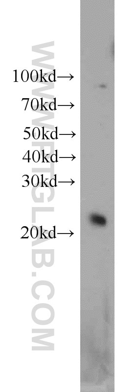 WB analysis of HepG2 using 14914-1-AP