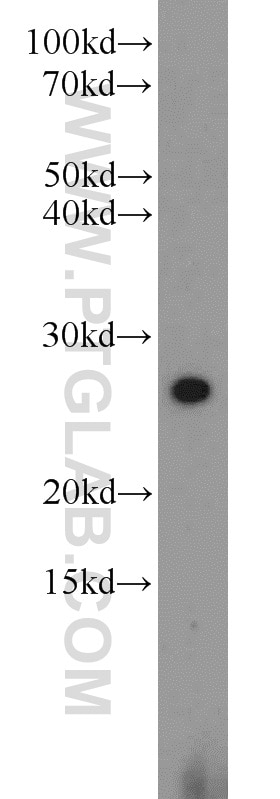 Western Blot (WB) analysis of A431 cells using HN1 Polyclonal antibody (14914-1-AP)