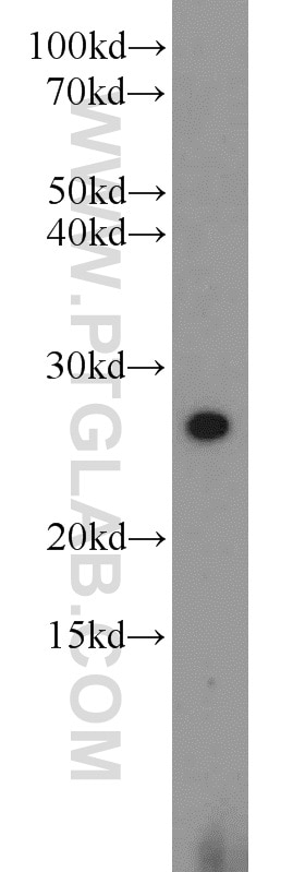 WB analysis of A431 using 14914-1-AP