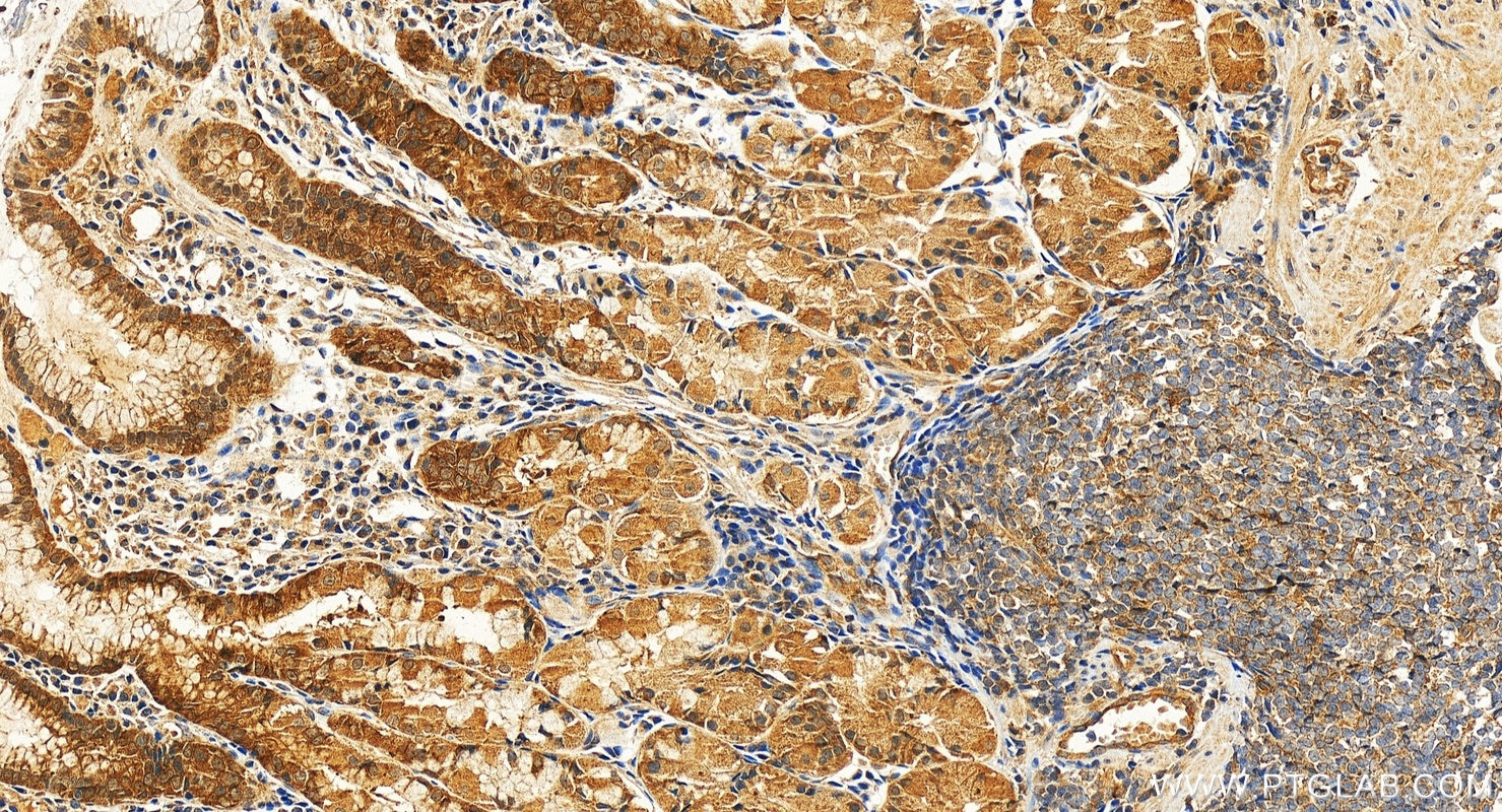 Immunohistochemistry (IHC) staining of human stomach tissue using HN1L Polyclonal antibody (16285-1-AP)