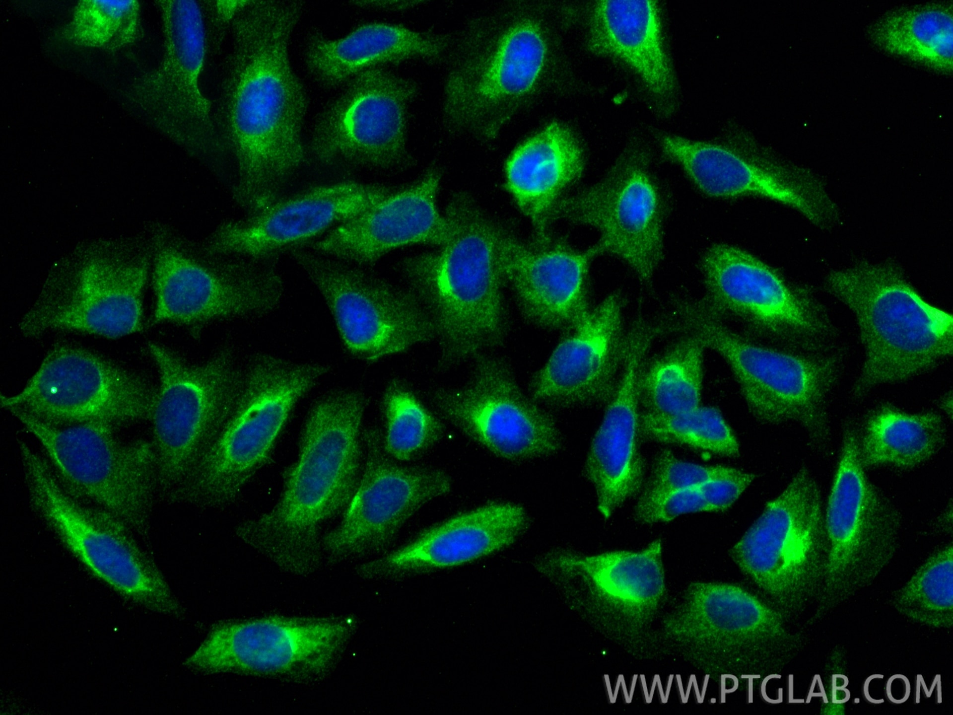 Immunofluorescence (IF) / fluorescent staining of U2OS cells using HN1L Polyclonal antibody (16285-1-AP)