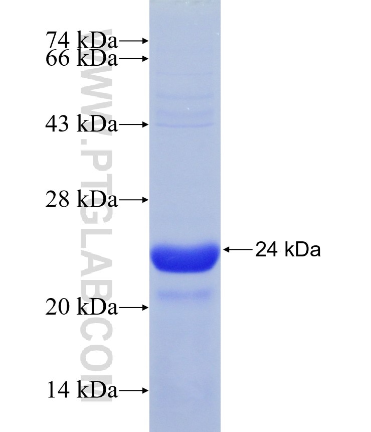 HN1L fusion protein Ag9415 SDS-PAGE
