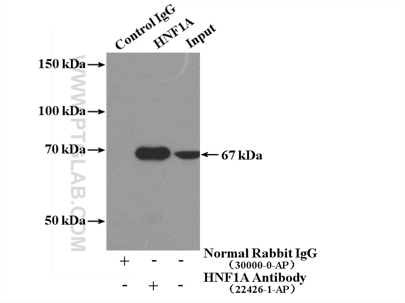 Immunoprecipitation (IP) experiment of mouse liver tissue using HNF1A Polyclonal antibody (22426-1-AP)