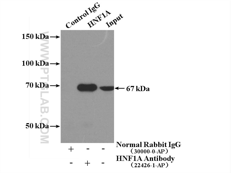 IP experiment of mouse liver using 22426-1-AP