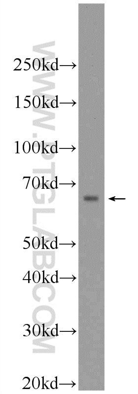 Western Blot (WB) analysis of SMMC-7721 cells using HNF1A Polyclonal antibody (22426-1-AP)