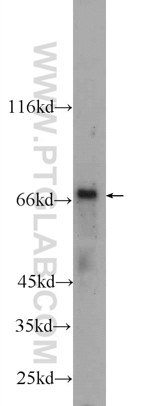 Western Blot (WB) analysis of rat liver tissue using HNF1A Polyclonal antibody (22426-1-AP)