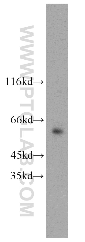Western Blot (WB) analysis of Jurkat cells using HNF1B Polyclonal antibody (12533-1-AP)