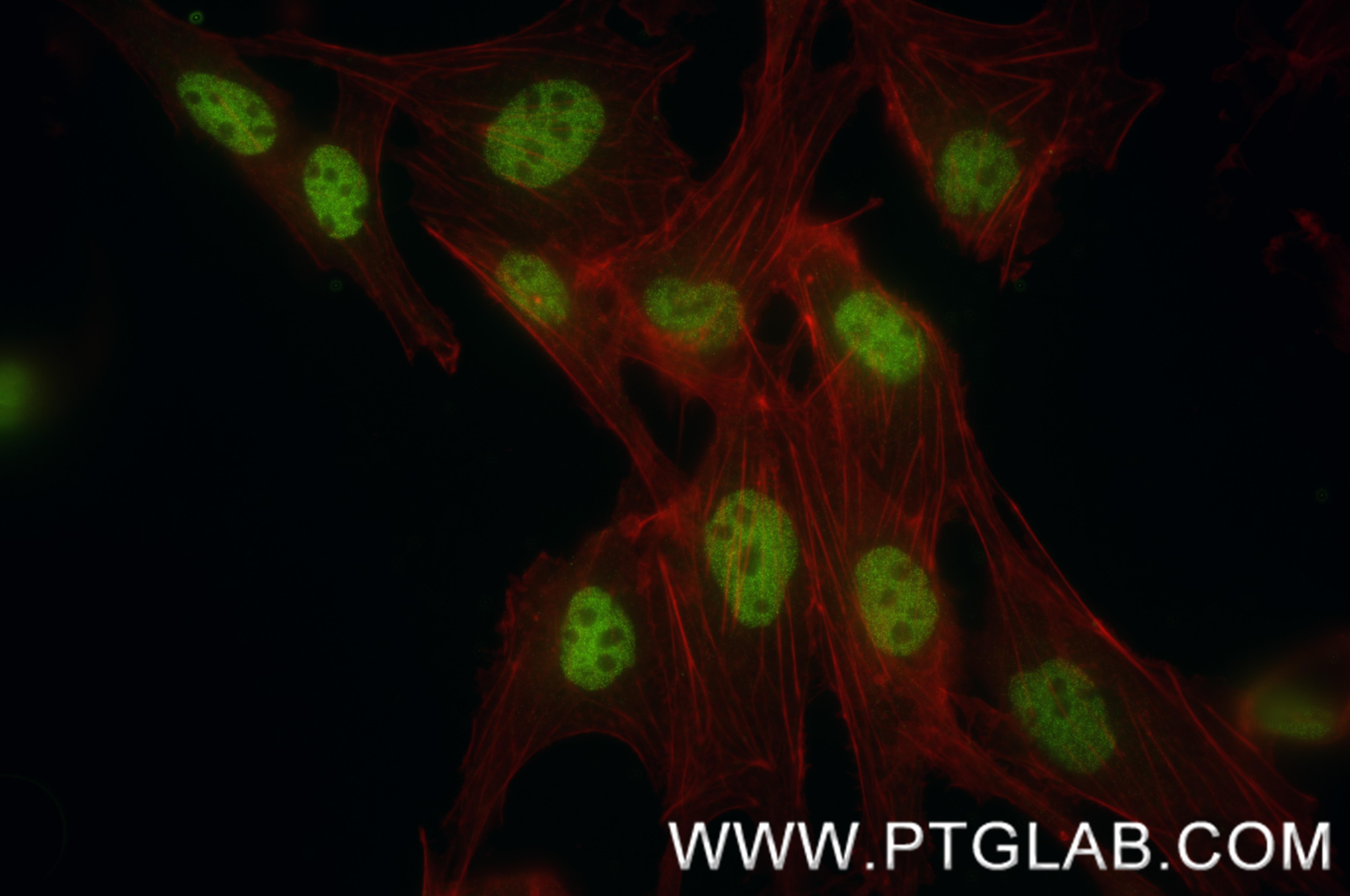 Immunofluorescence (IF) / fluorescent staining of MDCK cells using HNF1B Recombinant monoclonal antibody (84684-4-RR)