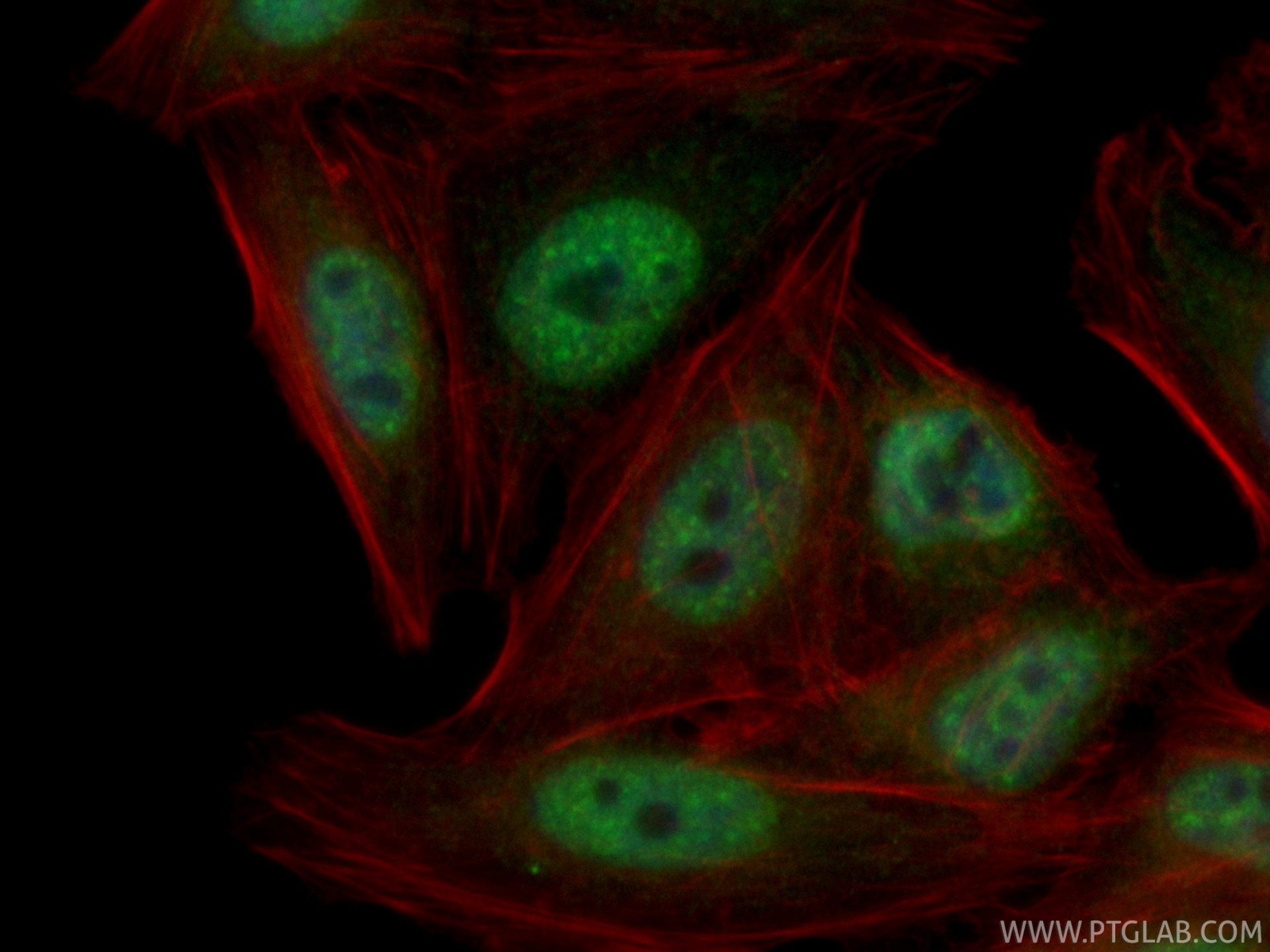 Immunofluorescence (IF) / fluorescent staining of HepG2 cells using CoraLite® Plus 488-conjugated HNF1B Recombinant mo (CL488-84684-5)