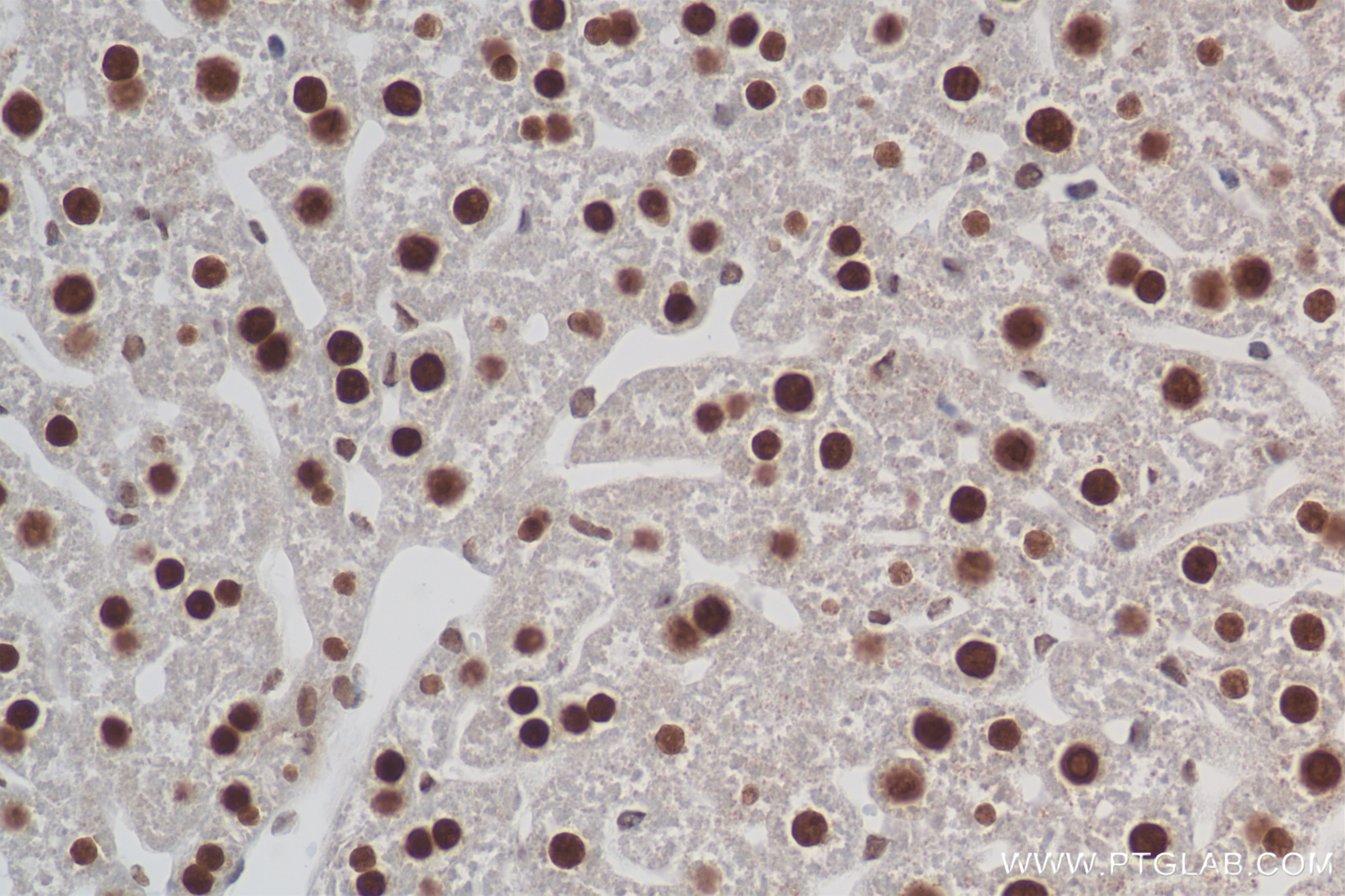 Immunohistochemistry (IHC) staining of mouse liver tissue using HNF4A Recombinant antibody (84316-7-RR)
