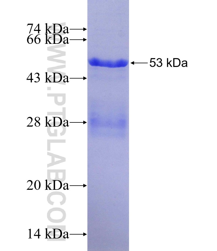 HNF4A fusion protein Ag27378 SDS-PAGE