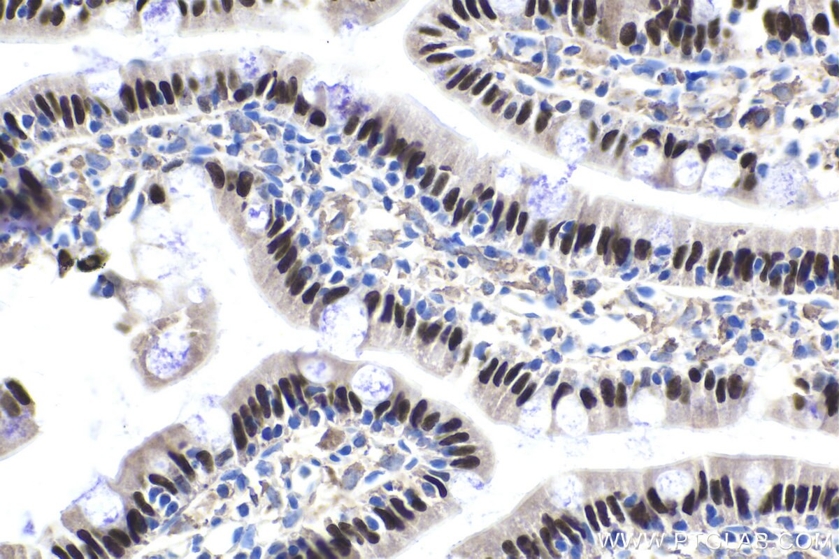 Immunohistochemistry (IHC) staining of rat small intestine tissue using HNF4G Polyclonal antibody (25801-1-AP)