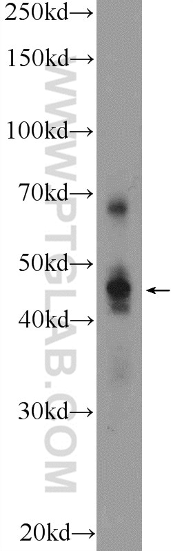 WB analysis of mouse kidney using 25801-1-AP