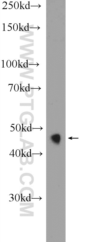 WB analysis of mouse pancreas using 25801-1-AP