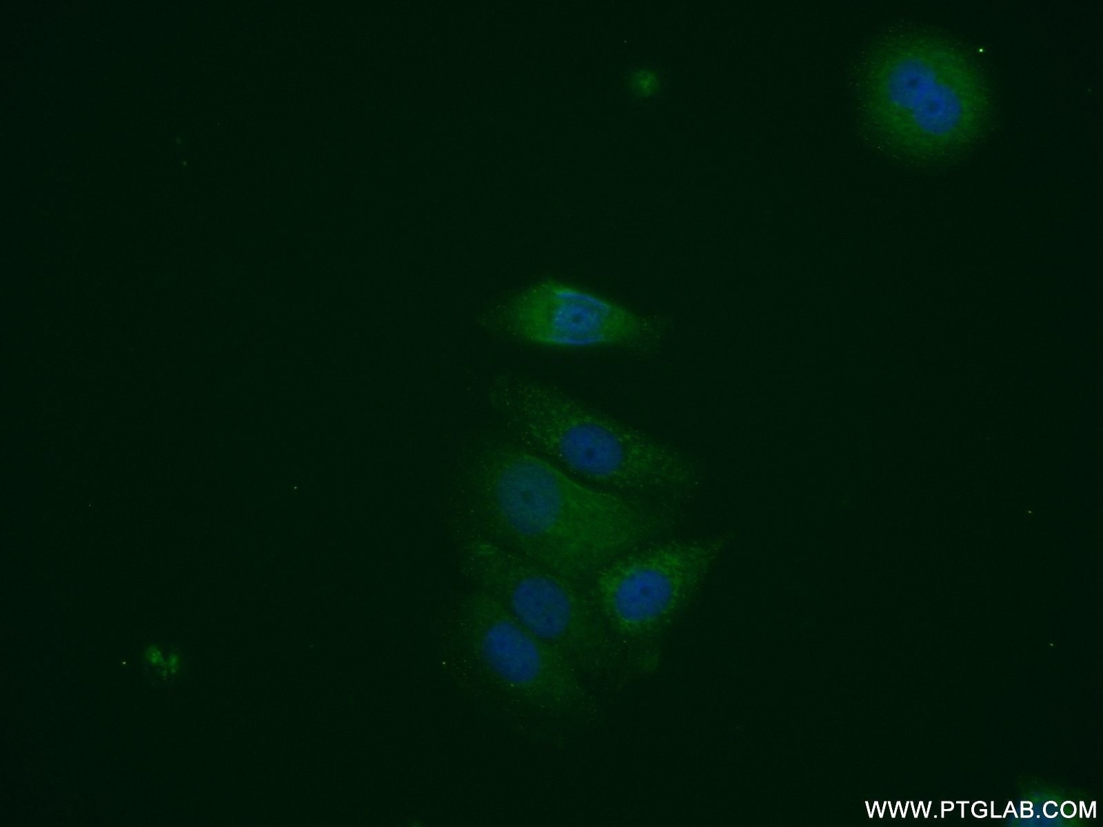 Immunofluorescence (IF) / fluorescent staining of MCF-7 cells using HNMT Polyclonal antibody (11874-1-AP)