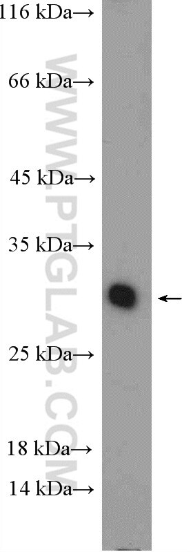 WB analysis of mouse liver using 11874-1-AP