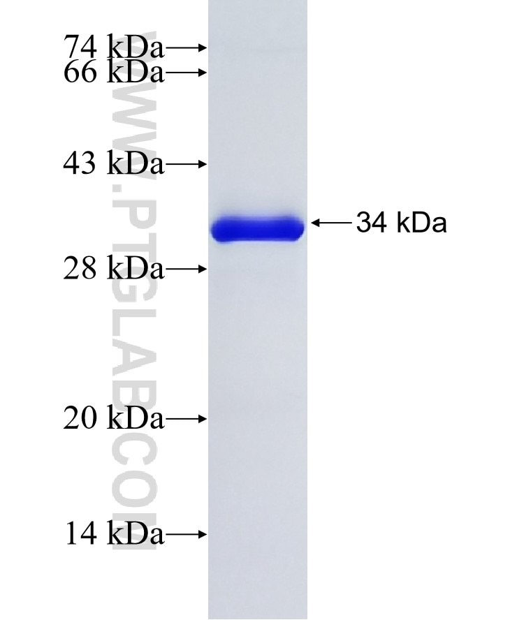 HNMT fusion protein Ag2462 SDS-PAGE