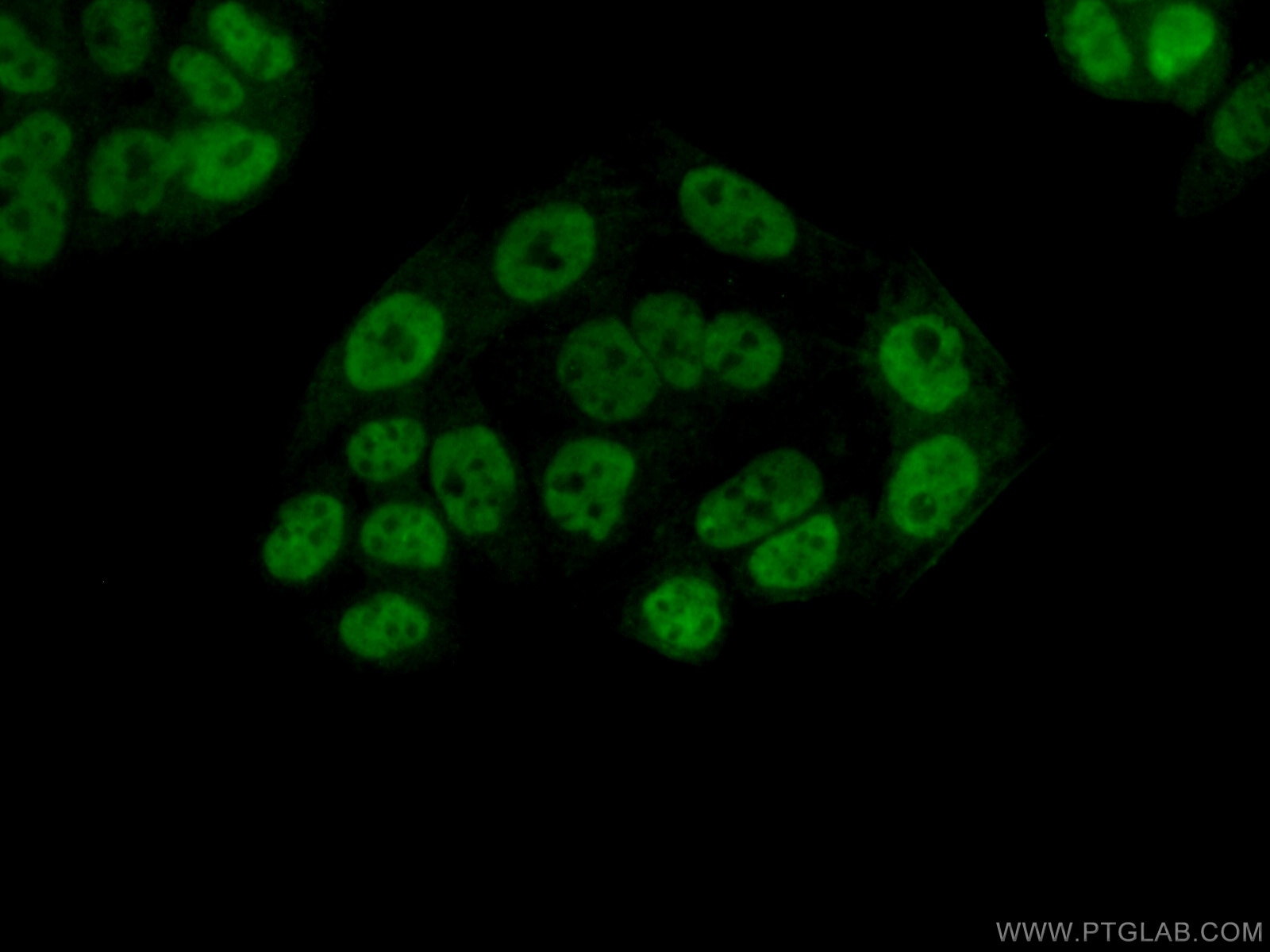 Immunofluorescence (IF) / fluorescent staining of HeLa cells using HNRNPA0 Polyclonal antibody (10848-1-AP)