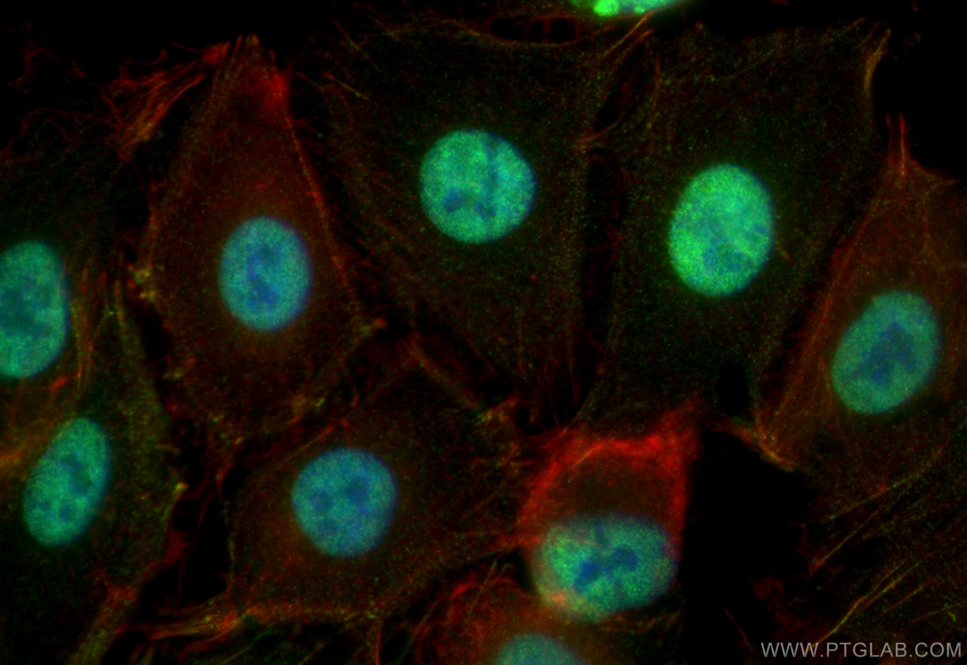 Immunofluorescence (IF) / fluorescent staining of A549 cells using HNRNPA0 Polyclonal antibody (10848-1-AP)