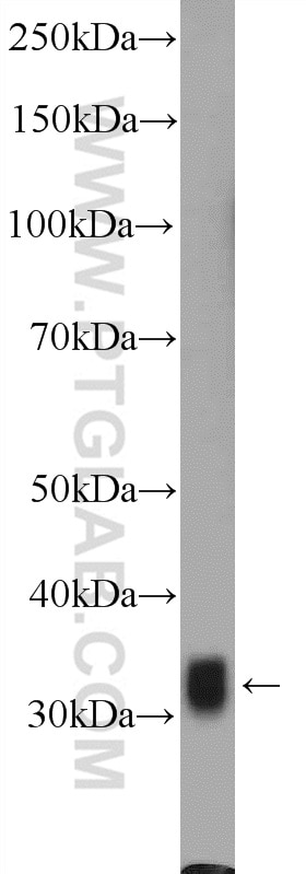 WB analysis of fetal human brain using 10848-1-AP