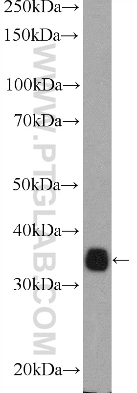 Western Blot (WB) analysis of HeLa cells using HNRNPA0 Polyclonal antibody (10848-1-AP)