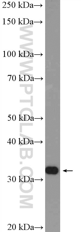 Western Blot (WB) analysis of mouse brain tissue using HNRNPA0 Polyclonal antibody (10848-1-AP)