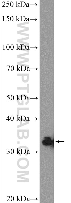 Western Blot (WB) analysis of HeLa cells using HNRNPA0 Polyclonal antibody (10848-1-AP)