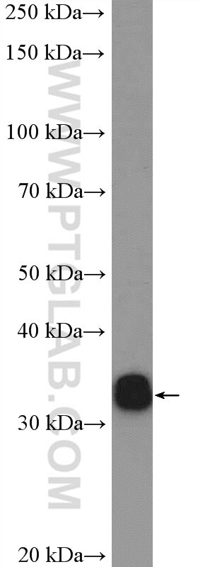 Western Blot (WB) analysis of HeLa cells using HNRNPA0 Polyclonal antibody (10848-1-AP)