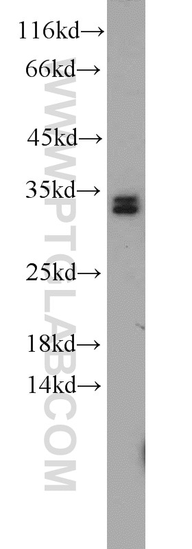 Western Blot (WB) analysis of human brain tissue using HNRNPA0 Polyclonal antibody (10848-1-AP)