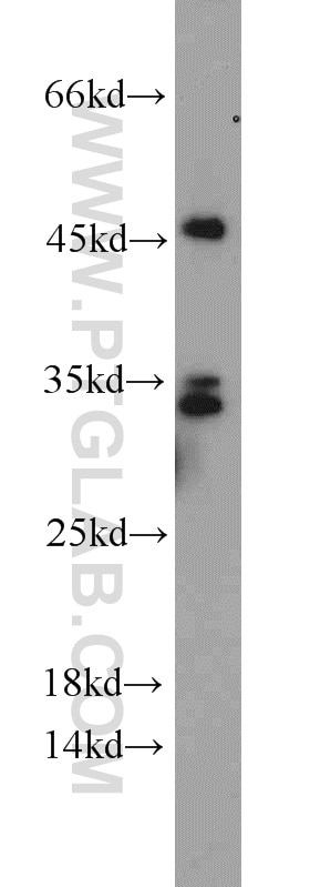 Western Blot (WB) analysis of HeLa cells using HNRNPA0 Polyclonal antibody (10848-1-AP)