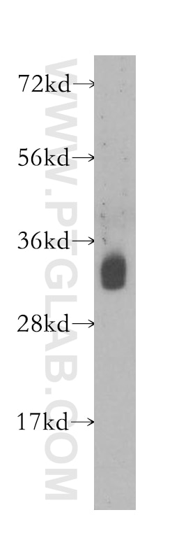 Western Blot (WB) analysis of human brain tissue using HNRNPA0 Polyclonal antibody (10848-1-AP)