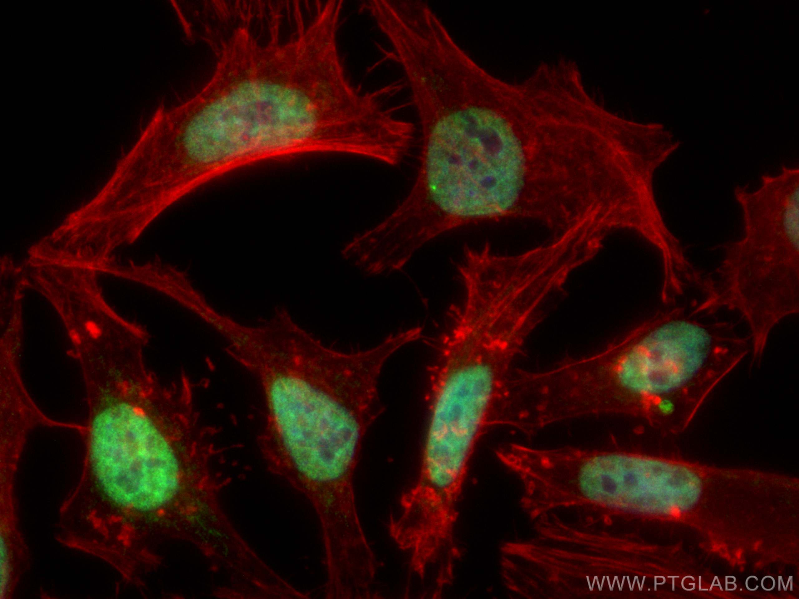 Immunofluorescence (IF) / fluorescent staining of HeLa cells using HNRNPA1 Polyclonal antibody (11176-1-AP)
