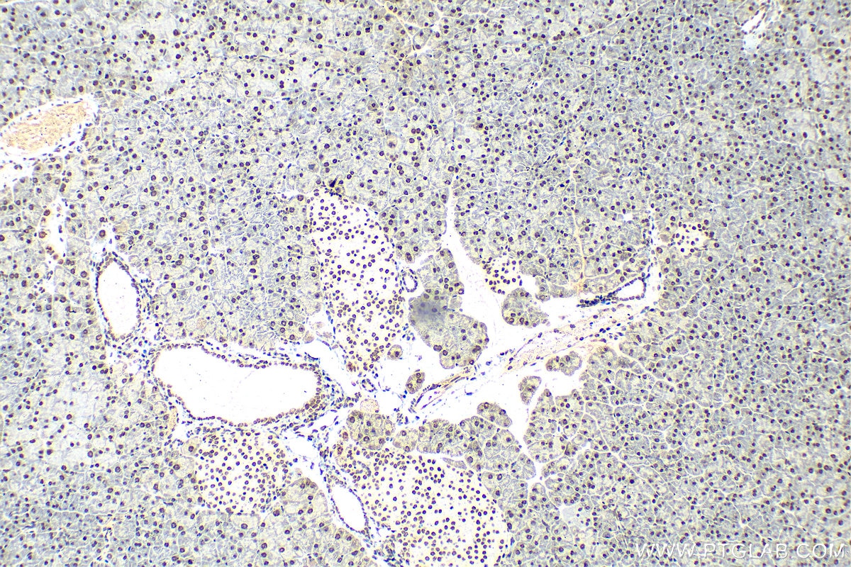 Immunohistochemistry (IHC) staining of mouse pancreas tissue using HNRNPA1 Polyclonal antibody (11176-1-AP)