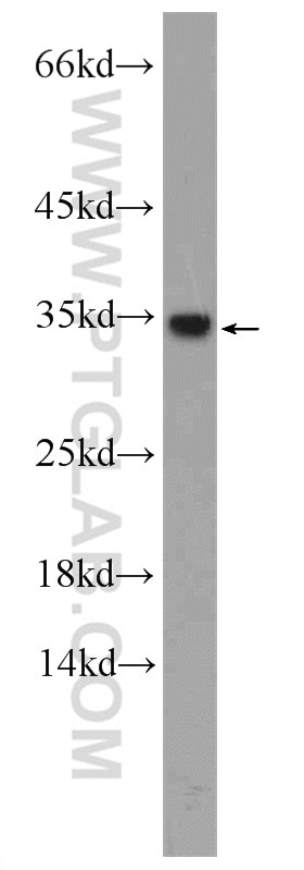 Western Blot (WB) analysis of mouse colon tissue using HNRNPA1 Polyclonal antibody (11176-1-AP)