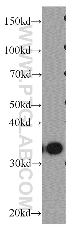 HNRNPA1 Polyclonal antibody