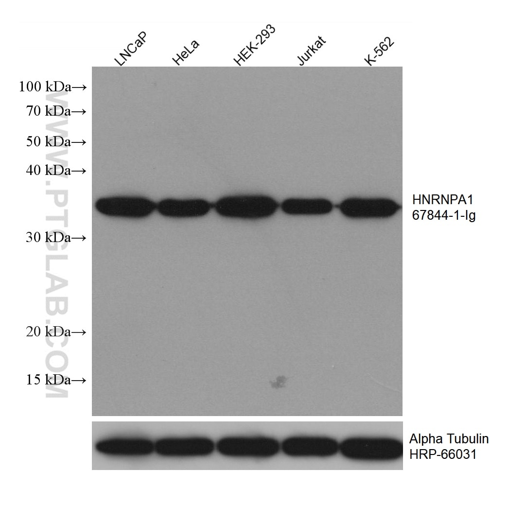 WB analysis using 67844-1-Ig