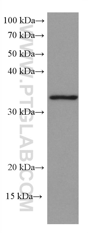 WB analysis of RAW 264.7 using 67844-1-Ig