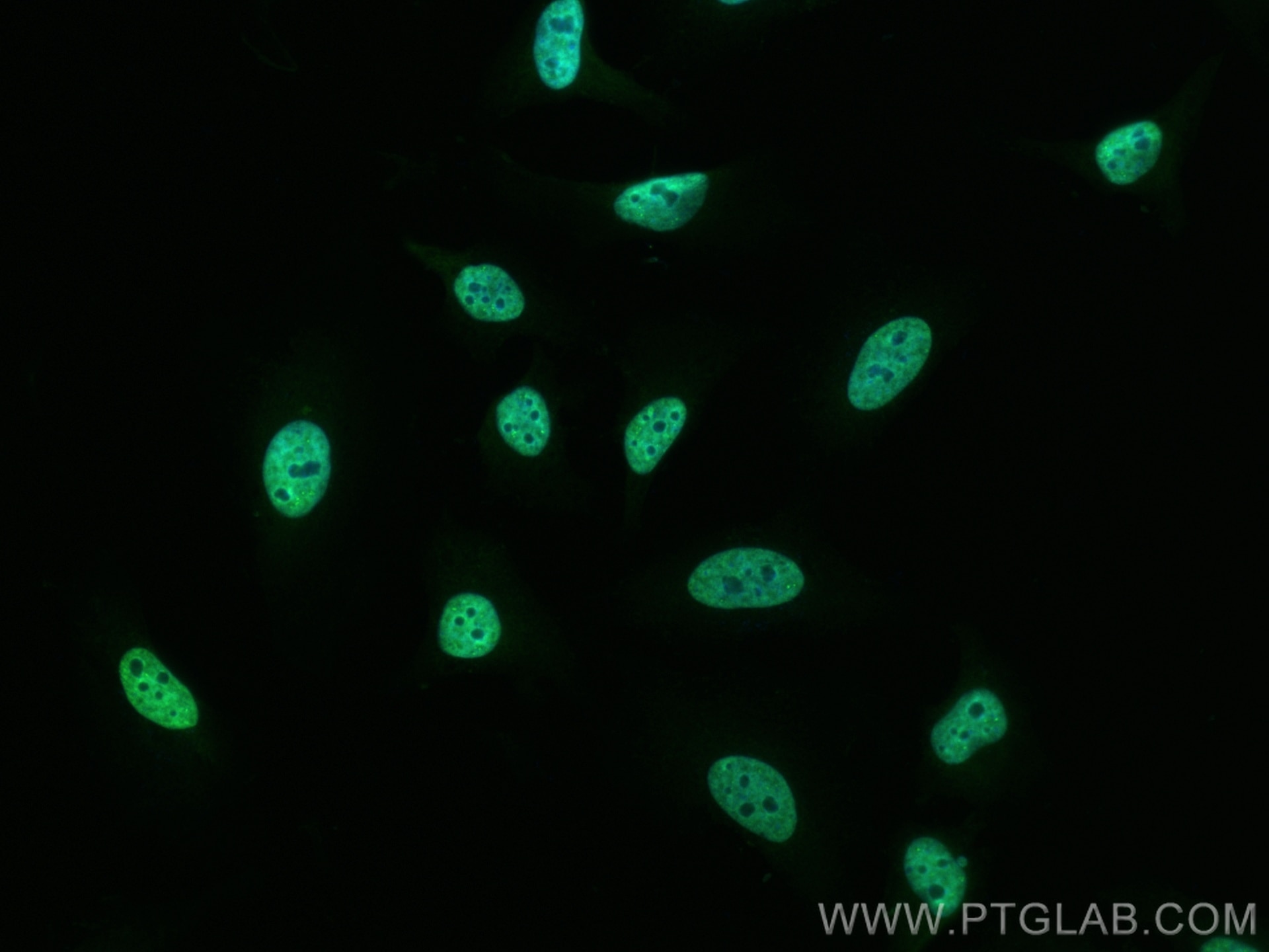 Immunofluorescence (IF) / fluorescent staining of HeLa cells using CoraLite® Plus 488-conjugated HNRNPA1 Monoclonal a (CL488-67844)