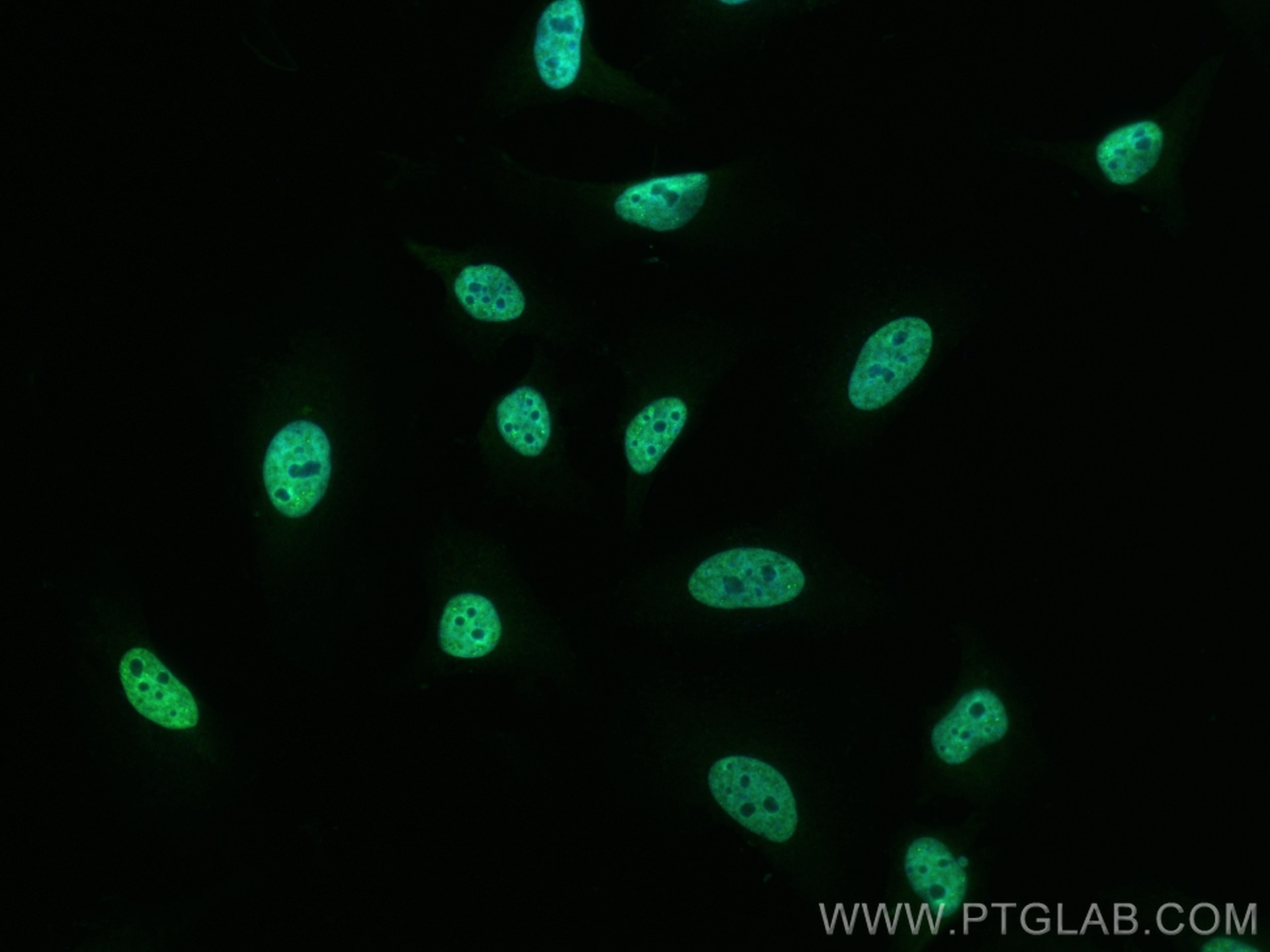 IF Staining of HeLa using CL488-67844