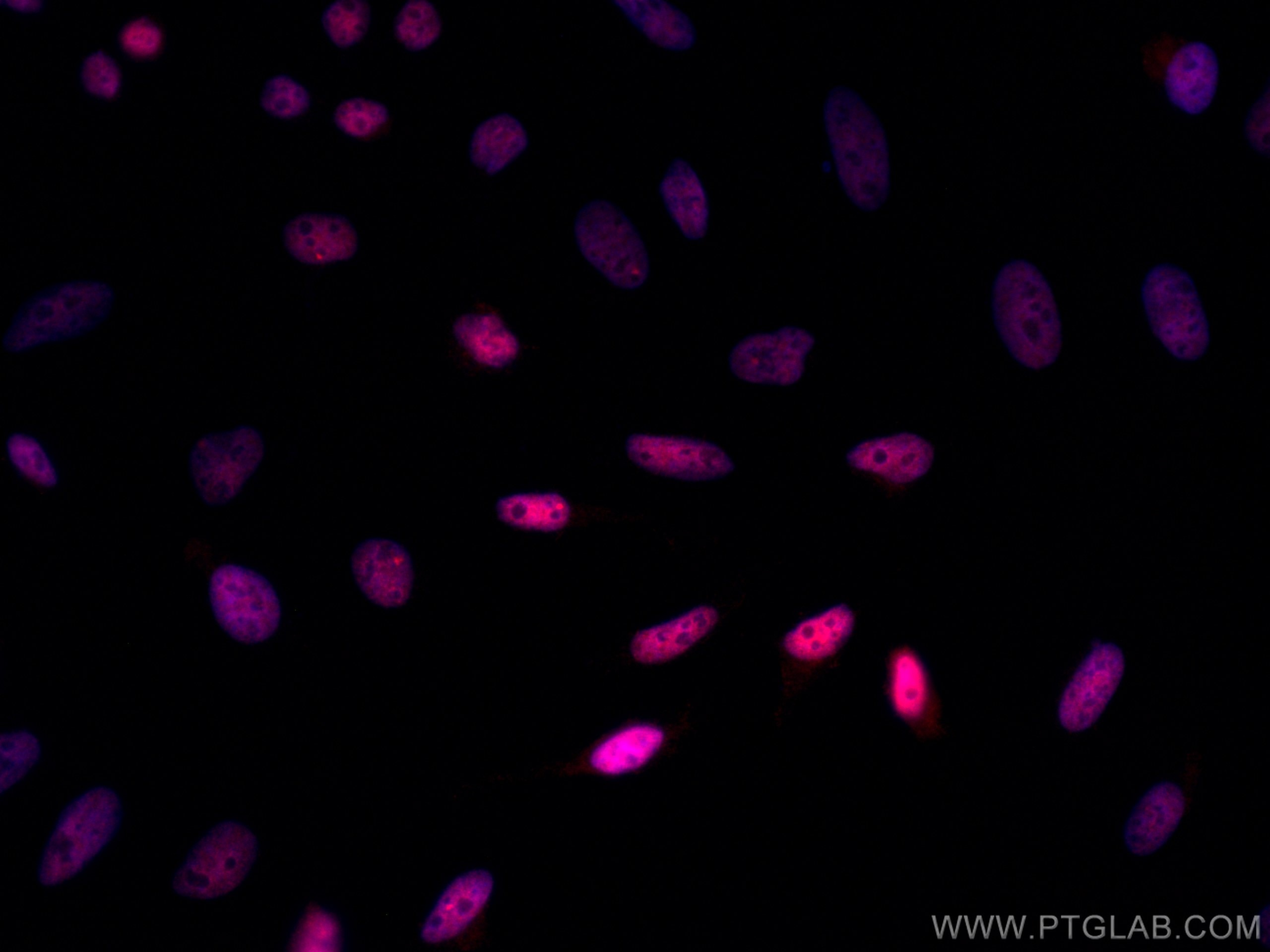 Immunofluorescence (IF) / fluorescent staining of HeLa cells using CoraLite®594-conjugated HNRNPA1 Monoclonal antibod (CL594-67844)