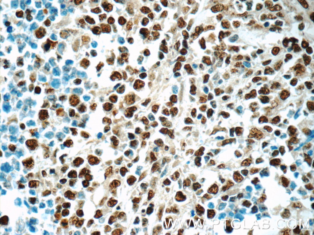 HNRNPA2B1 Polyclonal antibody