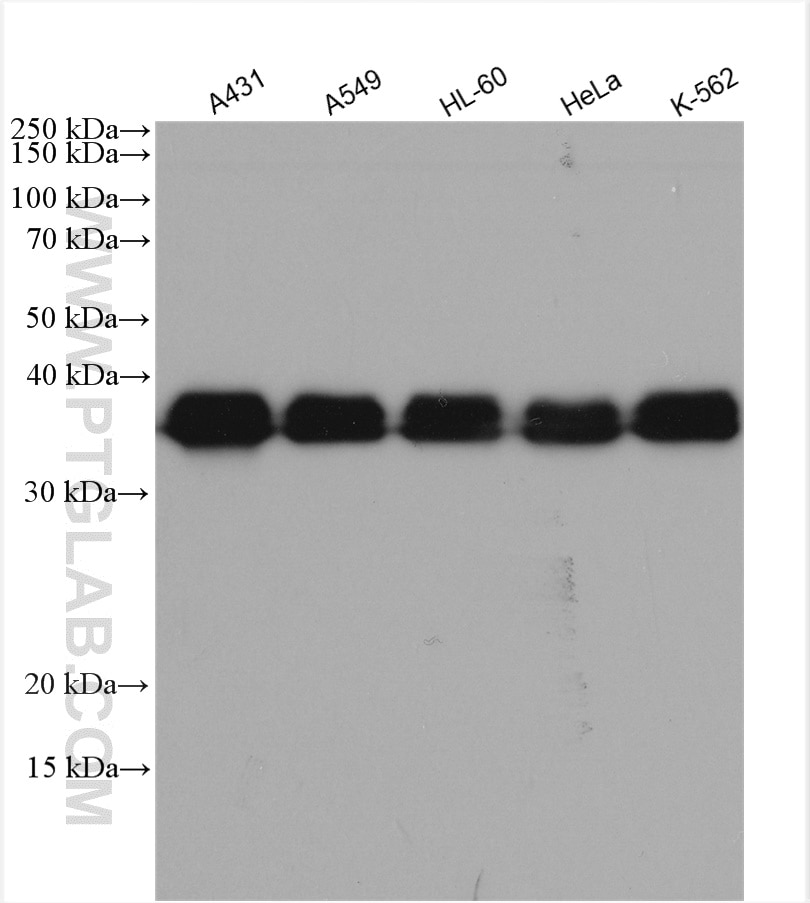 Western Blot (WB) analysis of various lysates using HNRNPA2B1 Polyclonal antibody (14813-1-AP)