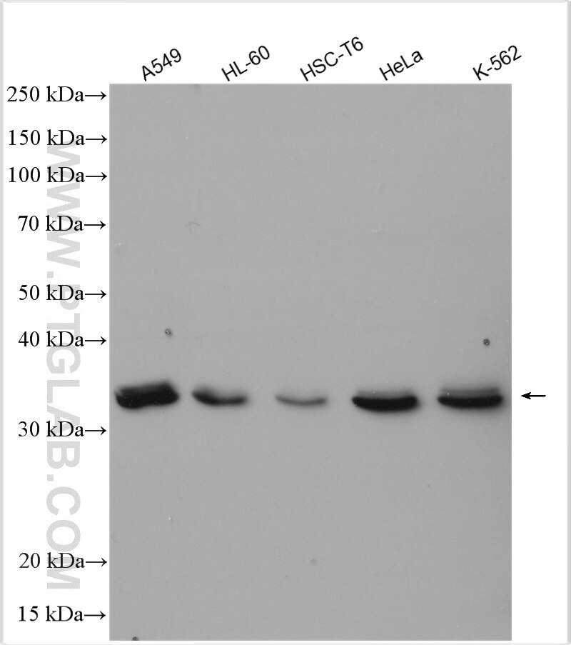 Western Blot (WB) analysis of various lysates using HNRNPA2B1 Polyclonal antibody (14813-1-AP)